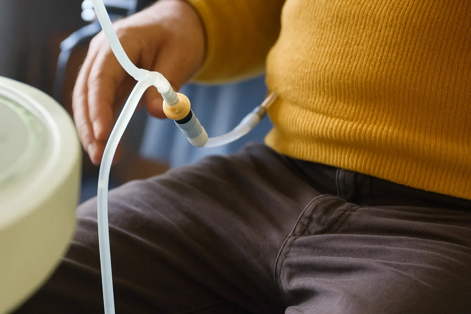 腹膜透析の画像